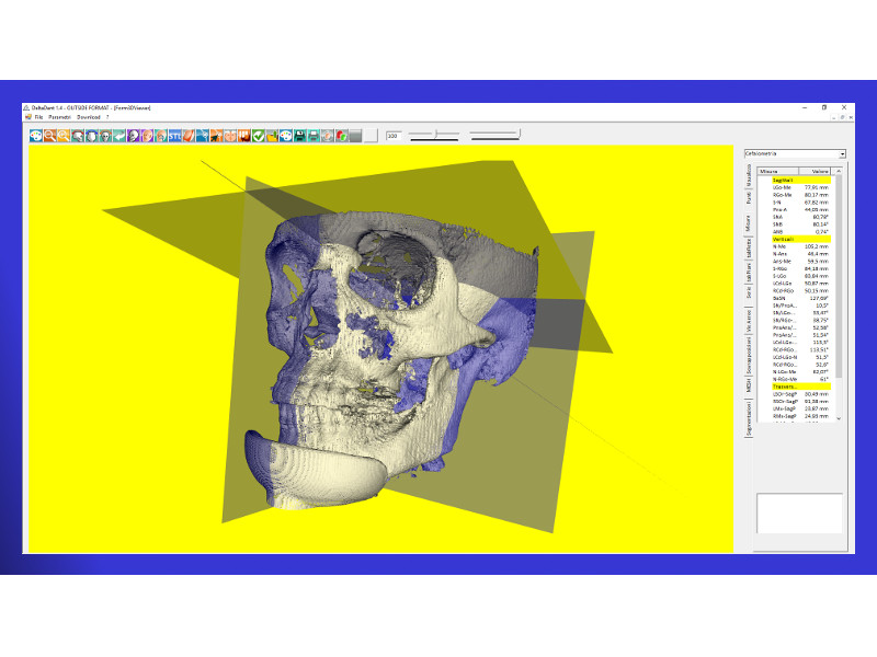 Dicom STL