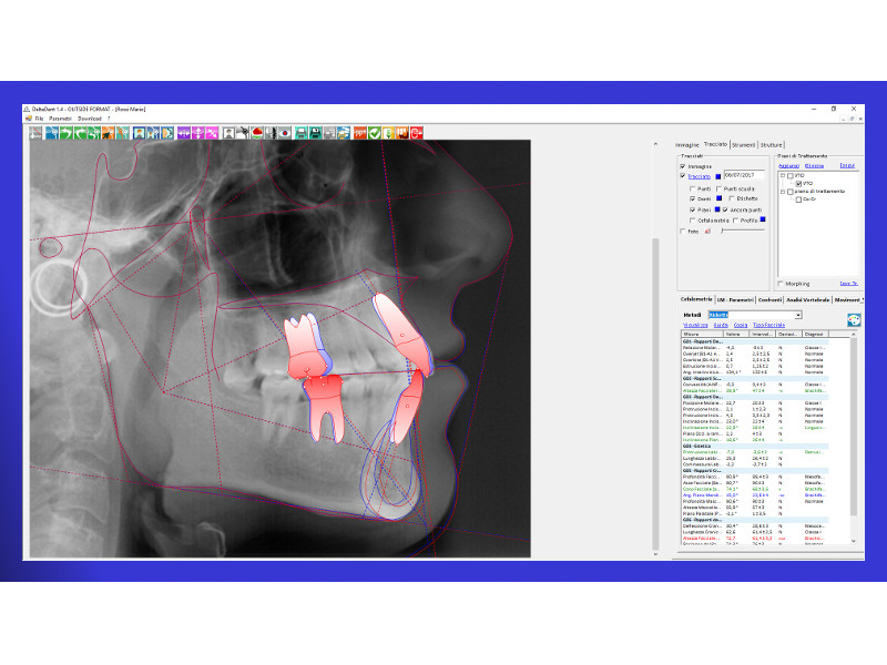 Cefalometric Tracing Treatments