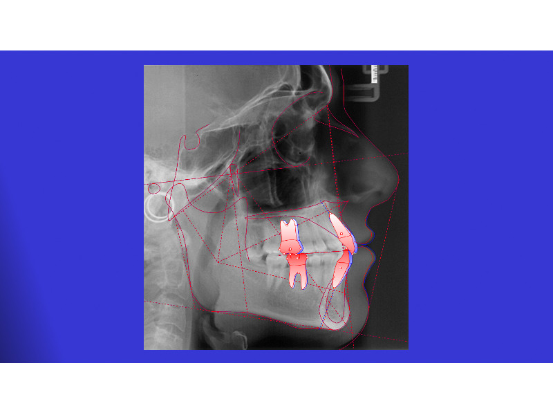 VTO ortodontico
