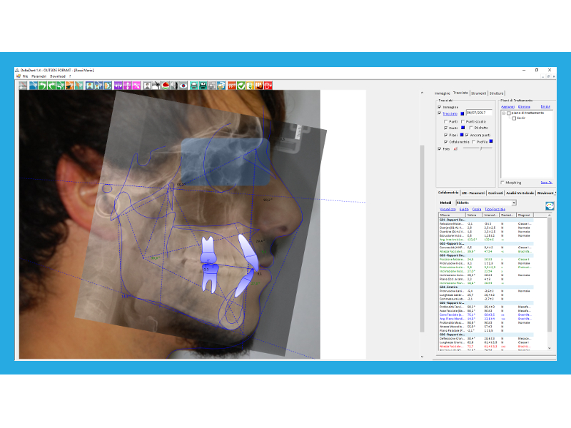 Tracciati Cefalometrici