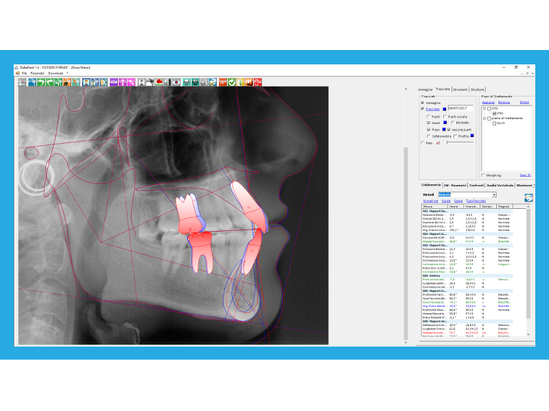 Tracciati Cefalometrici Trattamenti