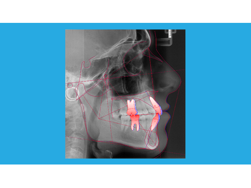 VTO ortodontico